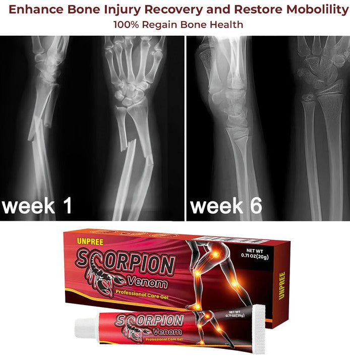 Scorpion™ Venom Professional Care Gel